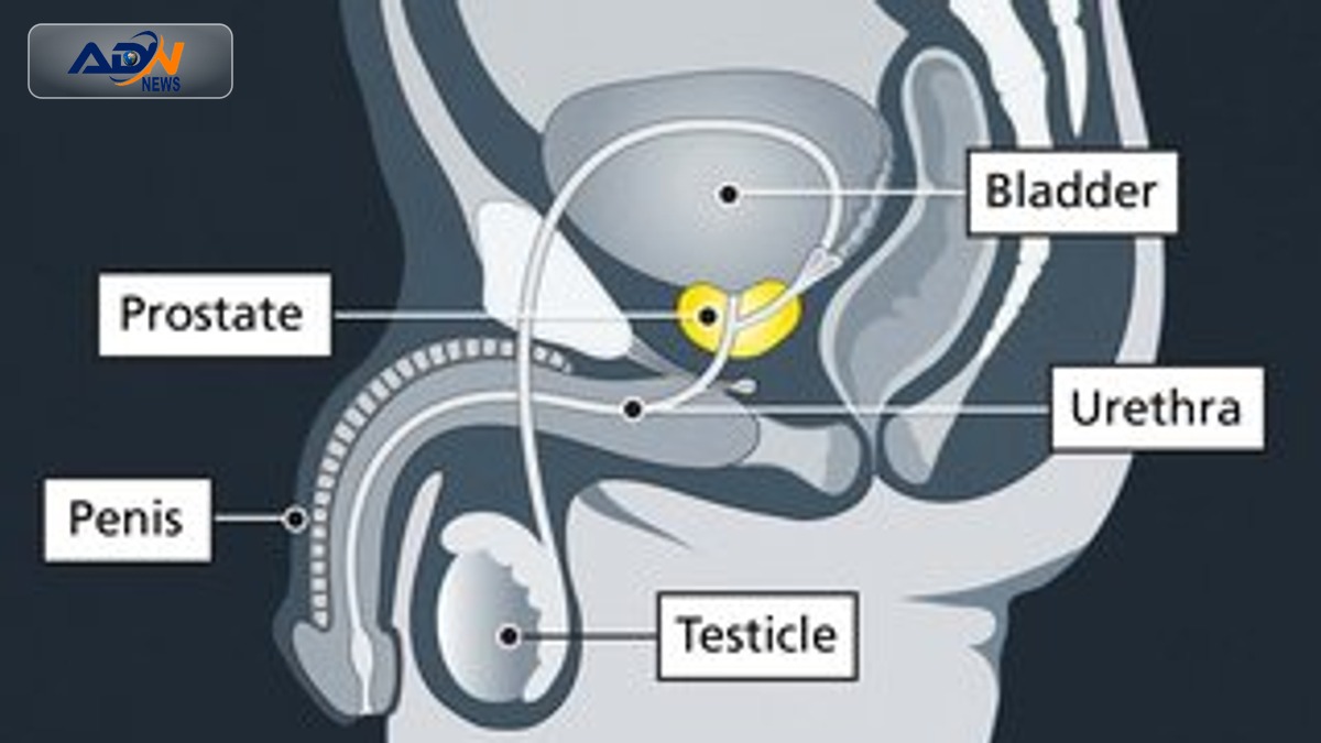 Prostate Cancer Treatment