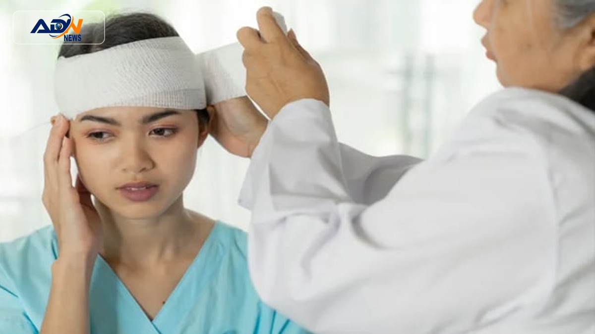 head injuries