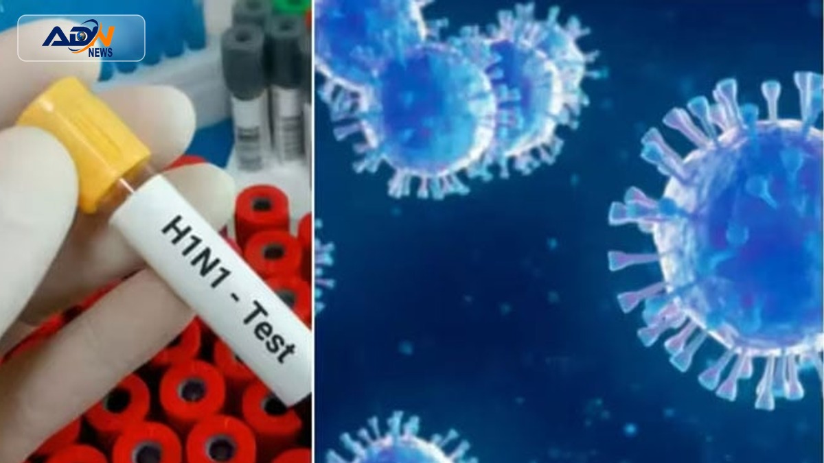 H1N1 Virus Karachi
