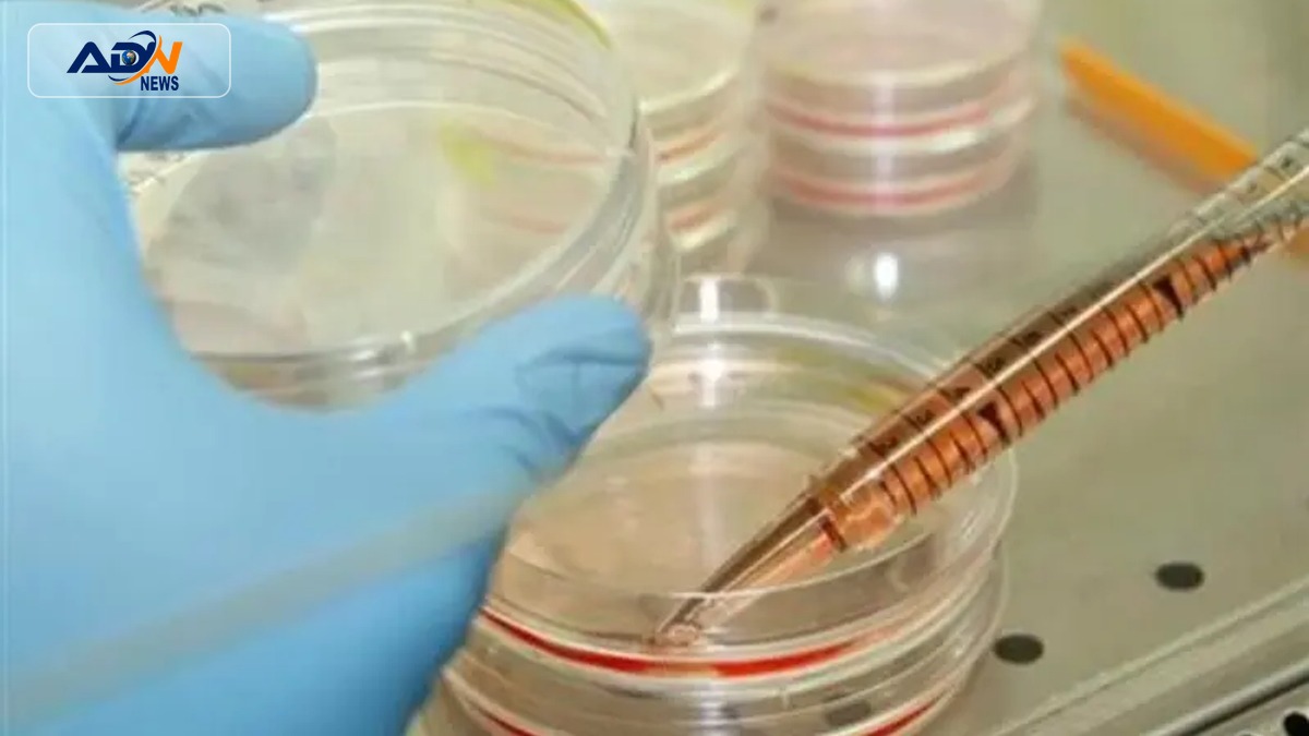 stem-cell treatment Parkinson's